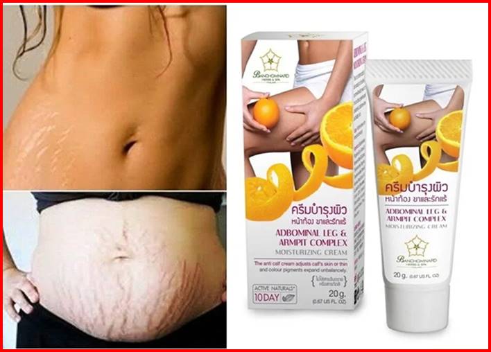 Tanned Stretch Marks Non-Surgical Ways to Reduce 2024