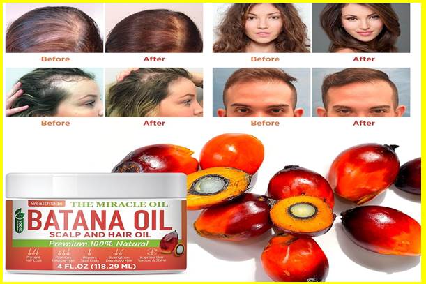 Can Batana oil regrow hair?